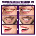 thumbnail image 3 of Enjuague bucal concentrado Jaysuing para mal aliento, manchas en los dientes, limpieza de dientes amarillos, boca fresca, enjuague bucal blanqueador de dientes BF |, 3 of 5