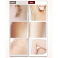 thumbnail image 3 of Depiladora Eléctrica Compacta Para Mujer, Para Rostro Y Cuerpo, Sensible A La Piel, Portátil, Funciona Con Pilas, 3 of 7