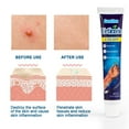 AURORA TRADE 20g Urticaria Cream Fast Absorbing Relieve Itching