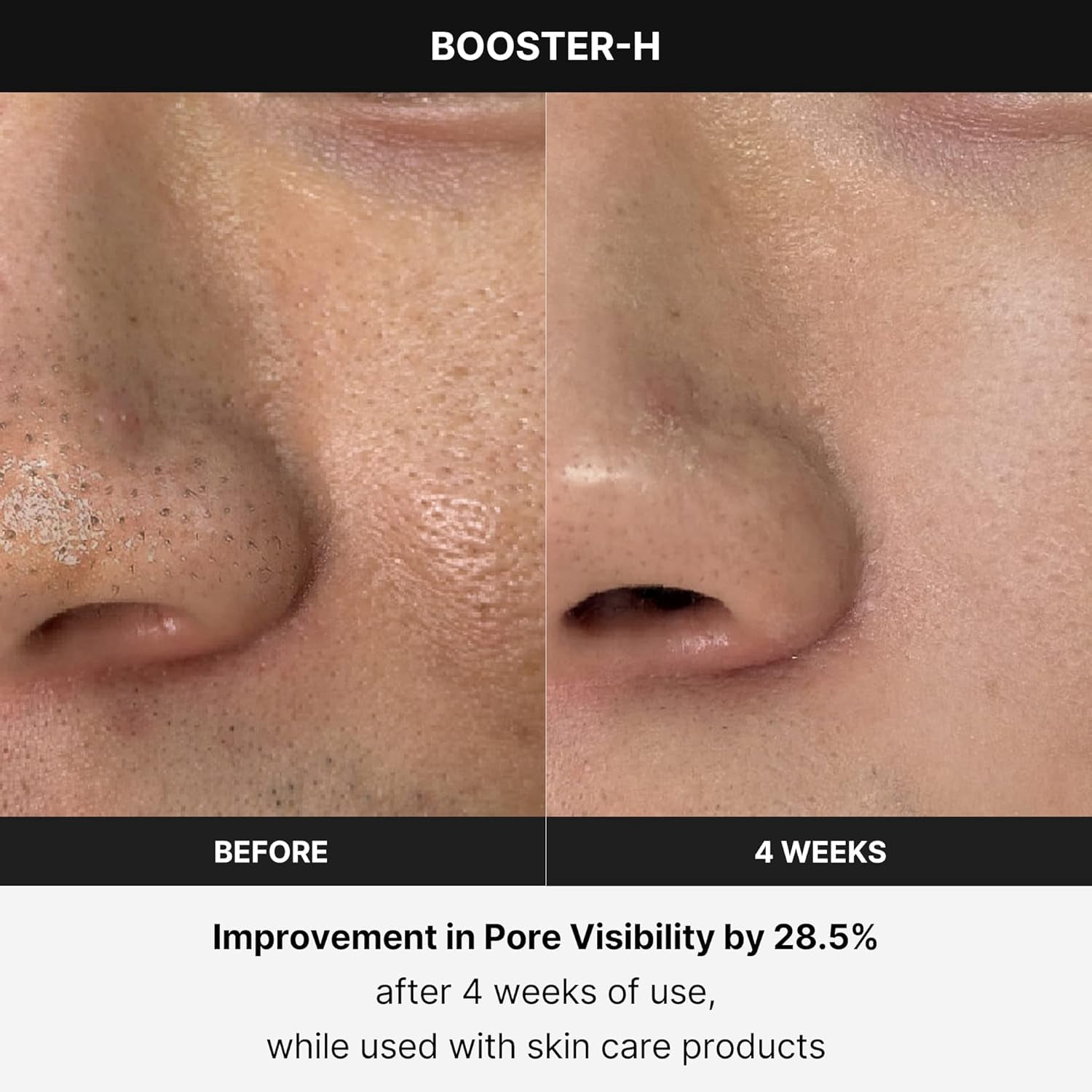 RKXQT Booster H - Korean Skincare Tool - Facial Glow Booster for Maximizing and Boosting Skin Care Absorption - Needle Free