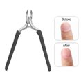 thumbnail image 3 of Pinzas Para Cutículas Recortadora Profesional De Acero Inoxidable Dead, 3 of 8