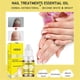 thumbnail image 4 of Aceite Esencial para el Cuidado de Hongos en las Uñas, Solución Antibacteriana para el Cuidado de los Pies y Manicura, 10ml, 4 of 5