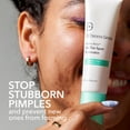 thumbnail image 3 of Dr. Dennis Gross Alpha Beta On The Spot Eliminator - 2% Salicylic Acid Acne Treatment Gel  1oz, 3 of 7