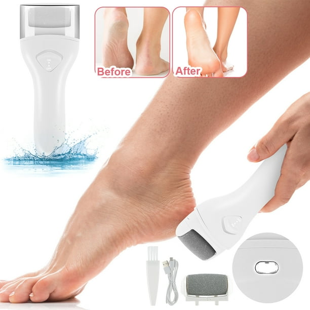Battery Operated Callus Remover