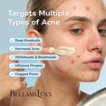 thumbnail image 3 of Crema para el tratamiento del acné BellamiLuxx con ácido salicílico 100 ml, 3 of 8