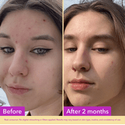 Good Molecules Niacinamide Serum - 10% Niacinamide to Target Blemishes, Nourishment, Skin Tone, Brightening Skincare for Face, 1 fl oz
