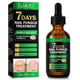 thumbnail image 1 of Nail Fungus Treatment, Ginger Nail Fungus Treatment, Toenail Cuticle Care Oil Care, Fungal Nail Treatment, 7 Days Nail Fungus Treatment for Toenail, 1 of 5