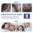 thumbnail image 3 of Sleep Mouth Strips for Nighttime Use, Skin-Friendly Gentle Adhesive, Comfortable & Easy to Remove - 2PACK, 3 of 9
