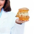 thumbnail image 4 of Implant Model, Pathological Anatomy Tooth Education, Reconstruction On Implant For  Schools Discussion Of Treatment, 4 of 8