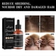 thumbnail image 3 of 1-3pcs Allurium Hair Growth Serum for Black Women, 2023 New Allurium Hair Growth Serum, 3 of 5