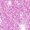 Pink, variant on Compatible for LG Stylo 5 Case, LG Stylo 5 Plus Case, LG Q Stylus Case, SOGA Glitter Diamond Rhinestone TPU Phone Cover with Ring Stand and Lanyard Girls Women Cover (Rose Gold)