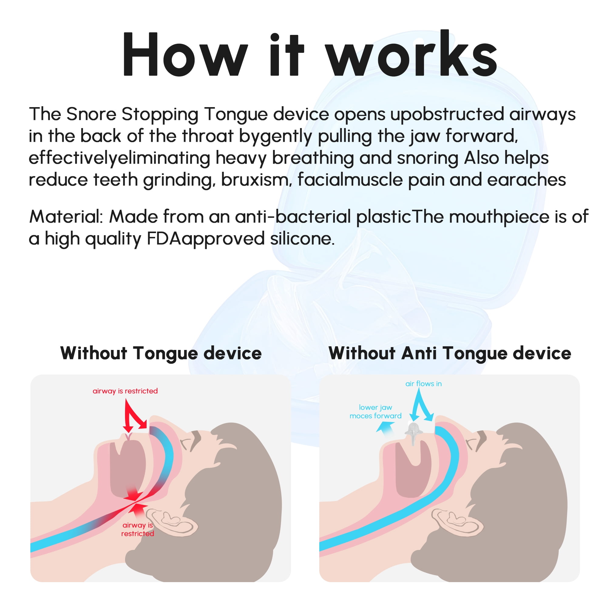 GENKENT Anti-Snoring Tongue Device: Sleep Apnea Aid, Snore Prevention ...