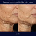 thumbnail image 3 of Sérum Estée Lauder Perfectionist Pro Rapid Firm + Lift 50 ml, 3 of 6