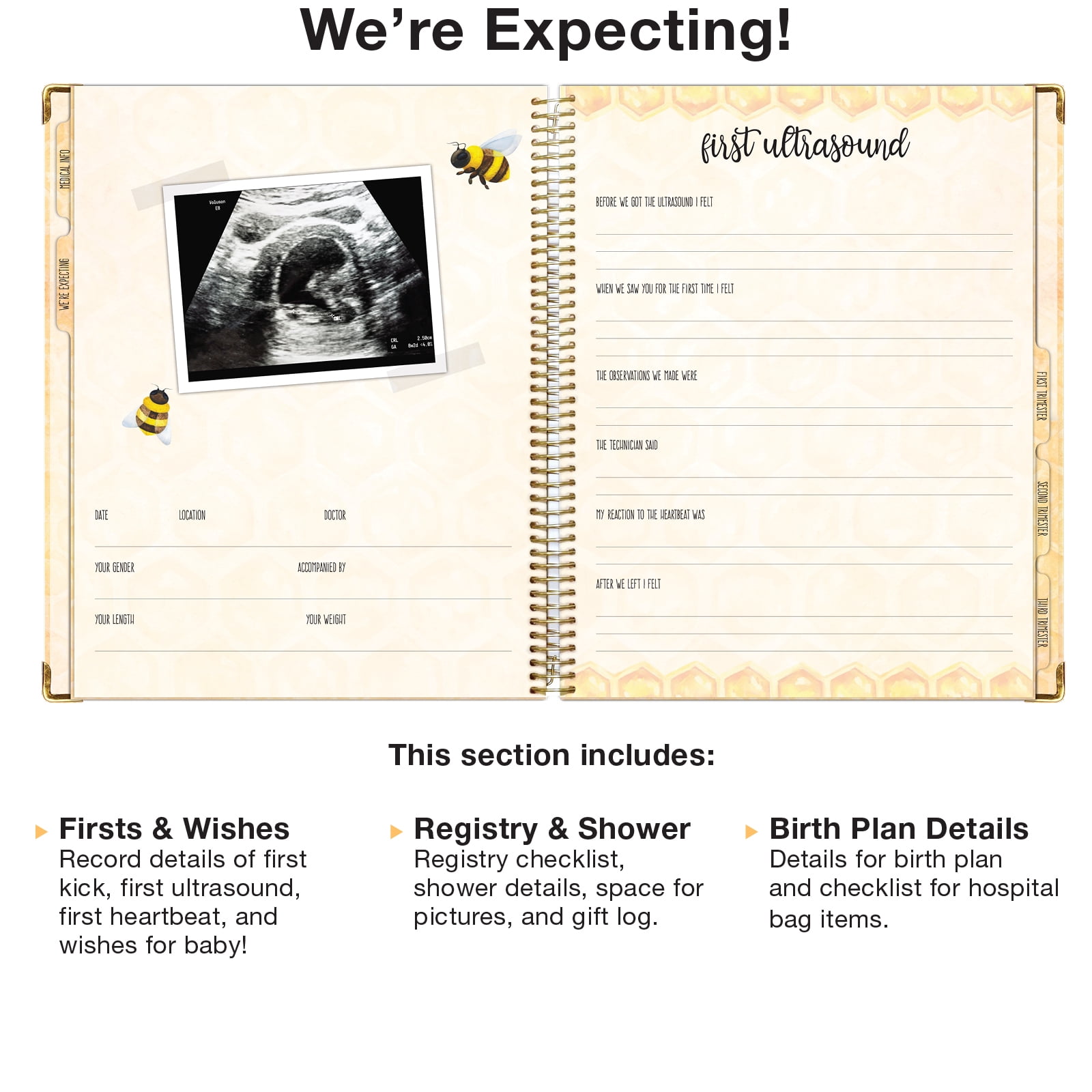 Global Printed Products Pregnancy Tracking Journal, 8.5" x 11"