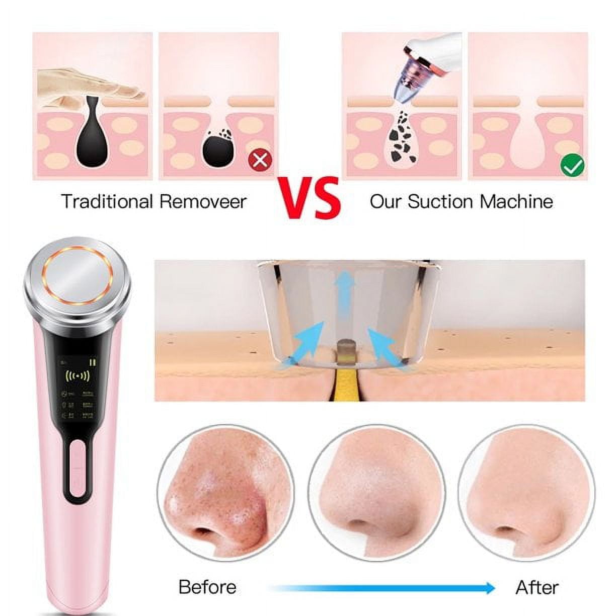 FACETRON 美顔器 50W 3335e6b7-c887-4d76-8ecf-