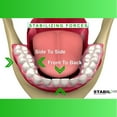 thumbnail image 6 of Stabil-Dent Do-It-Yourself Lower Denture Stabilizer Kit, Clear, DIY Kit, 6 of 9