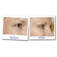 thumbnail image 4 of Eyelasticity: Age Defying Eye Therapy .5 fl oz/15 mL, 4 of 4