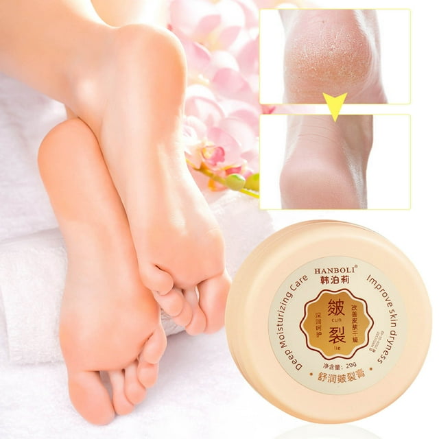 Fiudx Crema para Grietas, Bálsamo Hidratante Intensidad para Manos y Pies, Loción Reparadora para Piel Seca, Crema Exfoliante Suave para Callos, para Manos y Pies, para Todo Tipo de Piel, Solución pa