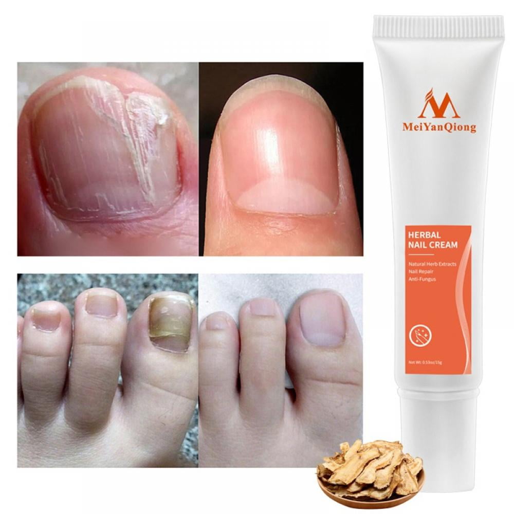 Orchip Nail Strengthening Cream, with Coconut Scent Nail Strengthener