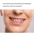 thumbnail image 3 of 10 Paquetes De Soportes De Ortodoncia Para Dientes Dentales De Metal, 022 Ranuras, 345 Ganchos Edgewise, 3 of 7