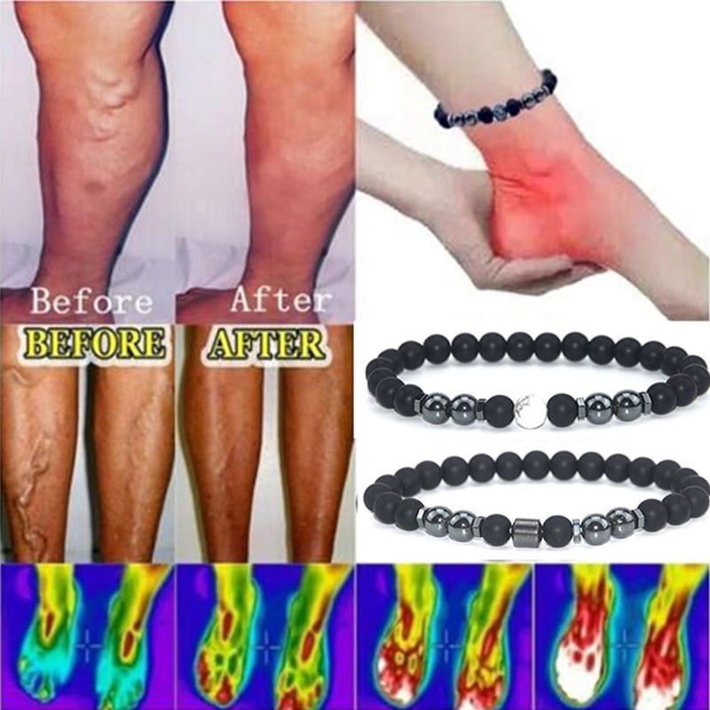 Anti-Swelling Black Obsidian Anklet 