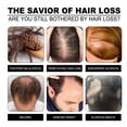 thumbnail image 4 of onlyliua Ofertas Navideñas Champú para Mantener El Cabello Sin Grasa, Sin Secuencia y Sin Picazón, 4 of 7