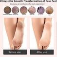 thumbnail image 5 of Foot Files Callus Remover 2 Pieces, Foot Files For Dead Skin Pedicure Tools (2pcs/pack), 5 of 5