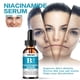 thumbnail image 3 of Esencia humectante Esencia facial de niacinamida para pieles secas, opacas y ásperas Hidratante facial Blanqueamiento de la piel, 3 of 6