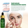 thumbnail image 5 of JIN Tratamiento del acné Suero facial Reductor de poros Cuidado de la piel Contra el acné en la cara Eliminador de manchas de acné Limpieza Reductor de poros Suero de árbol de té, 5 of 5