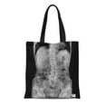 thumbnail image 1 of ASHLEIGH Canvas Tote Bag Column Scoliosis Film X Ray Lumbar Spine Ap Disc Durable Reusable Shopping Shoulder Grocery Bag, 1 of 1
