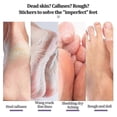 thumbnail image 3 of Ginger Foot Mask For Chapped Feet Skin, Exfoliating, Exfoliating, Moisturizing, Rejuvenating And C, 3 of 5
