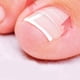 thumbnail image 5 of 120 piezas de parches correctores para uñas encarnadas, soporte para uñas curvadas Grueso, 5 of 5