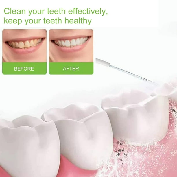 Limpiador de dientes instrumento de limpieza de pulso electrico diente de presion de agua fuerte TFixol Irrigador oral portatil