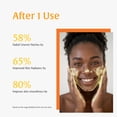 thumbnail image 6 of 2-in-1 Turmeric & Kojic Acid Brightening Set : Amino Acids Foam Cleanser + Exfoliating Gel Peel Shot, Dead Skin Remover for Face and Body, Underarms, Knees, Brightening & Dark Spot Corrector, 6 of 13