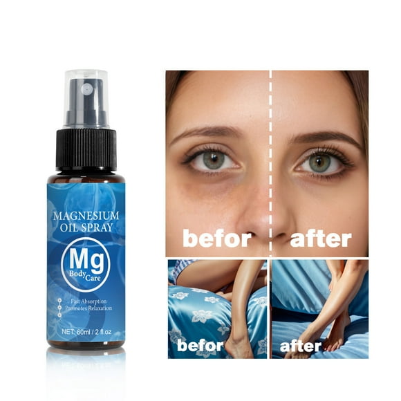 Fiudx Aceite de Magnesia En Espray, Cuidado Corporal Nutritivo con Árbol de Té, Magnesio Regenerador para La Relajación, Espray Hidratante para Aliviar La Sequedad, Cuidado de Pies, Piernas y Brazos,