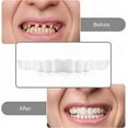 SMILE INSTANT Natural Dental Veneers, 1 Pair Unisex False Teeth Cover