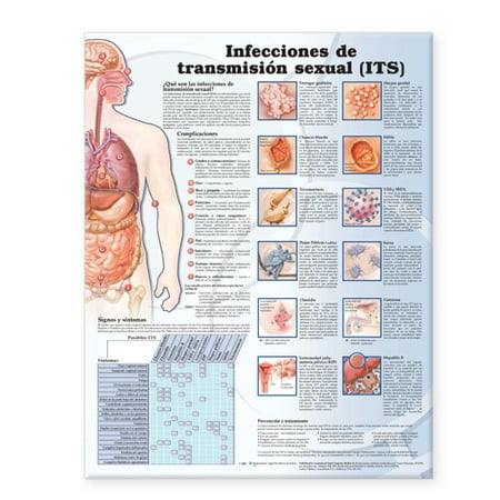 Sexually Transmitted Infections Anatomical Chart in Spanish (Infecciones de transmisión
