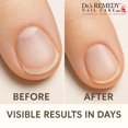 thumbnail image 3 of Tratamiento de esmalte de uñas Dr. ' Sérum para uñas S Remedy Nourish, 3 of 5