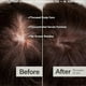 thumbnail image 4 of Hair Ampoule Serum Leave-In Scalpy Hair Nourishing Serum Hair Loss Treatments Essence for All Hair Types, 4 of 5