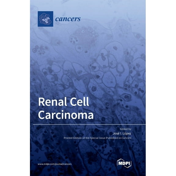Renal Cell Carcinoma, (Hardcover)