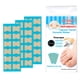 thumbnail image 1 of 1 juego de cinta adhesiva de corrección de pie profesional para el ángulo del 36 hojas Zulema corrector de uñas encarnadas, 1 of 8