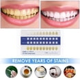 thumbnail image 3 of Shisuyan Tooth Color Chart Tooth Color Contrast Cards Blue PVC 20Pcs 3.3X2.1X0.8In, 3 of 8
