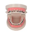thumbnail image 1 of Modelo Avanzado de Ortodoncia con Soportes Metálicos Duraderos, 1 of 5