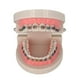thumbnail image 1 of Modelo Avanzado de Ortodoncia con Soportes Metálicos Duraderos, 1 of 5