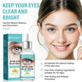 thumbnail image 6 of Stye Eye Treatment,Eye Serum Eye Cream for Chalazion and Blepharitis,30ml, 6 of 8