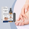 thumbnail image 2 of Nail Fungus Treatment for Toenail, Extra Strong Toenail Fungal Nail Treatment Nail Repair Growth Treatment Nail Softener for Thick Toenails Toe and Fi, 2 of 5