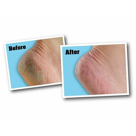 O'Keeffe's Healthy Feet Foot Cream Tube 3 oz (Pack of 4)