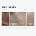 thumbnail image 3 of Tónico facial, tónico facial con ceramidas, calmante, sensible, reparador, localizado, loción hidratante y suavizante, 100 ml. Piel refrescante., 3 of 5