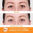 thumbnail image 2 of Kit de parches para ojos Peter Thomas Roth con vitamina C e hialurónico, 2 of 6