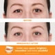 thumbnail image 2 of Kit de parches para ojos Peter Thomas Roth con vitamina C e hialurónico, 2 of 6
